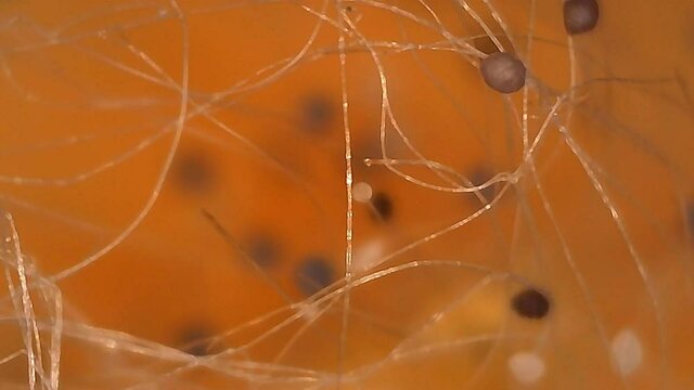 Microscope Mold on Pumpkin Spores 750x to 1200x Biology Fungi