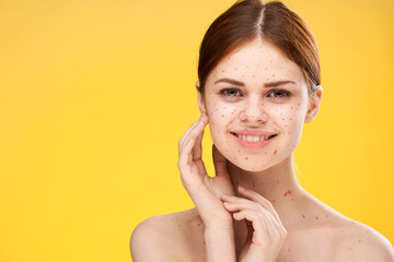 woman with bare shoulders red dots on her face health problems dermatology