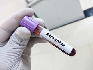 Obraz premium Blood sample for Nairovirus PCR test, Congo hemorrhagic fever, Nairobi sheep disease virus