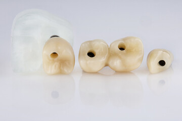 Temporary dental crowns chewing teeth on a white background