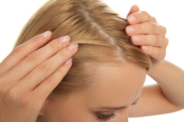 Woman with hair loss problem on white background, closeup. Trichology treatment