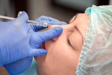 Cosmetic procedure for non-surgical rhinoplasty. Beautician injects hyaluronic acid into the nose...