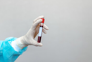 A test tube with a blood test without an inscription. The hand of a doctor (nurse) holds a test tube. Selective focus