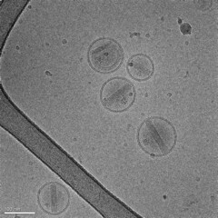 Electron image of nanoparticles made of lipids containing an anticancer drug