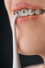 Close-up of an oral cavity with braces and an irrigator. Young unrecognizable woman. Dental hygiene concept.