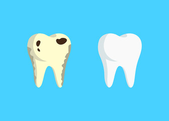 flat style illustration of healthy white tooth and yellow tooth with caries on a blue background. concept of comparing teeth, caries treatment before after