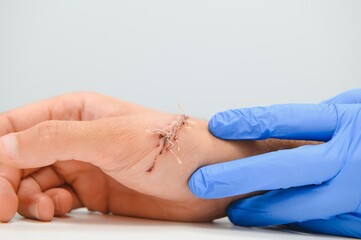 examination by a doctor of a cut on the arm