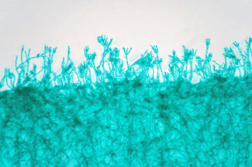 Penicillium(mold) under the light microscopic view.