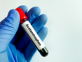 Fototapeta premium Hand hold Blood sample for Somatostatin test.