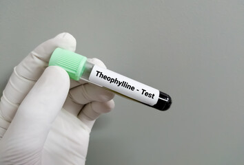Fototapeta premium Blood sample for Theophylline test, drug therapy.