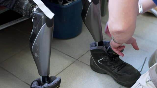 Medical prosthetics technician is checking male artificial bionic high technology legs prosthesis in clinic. A man living with a disability came to doctor to check his artificial legs prothesis