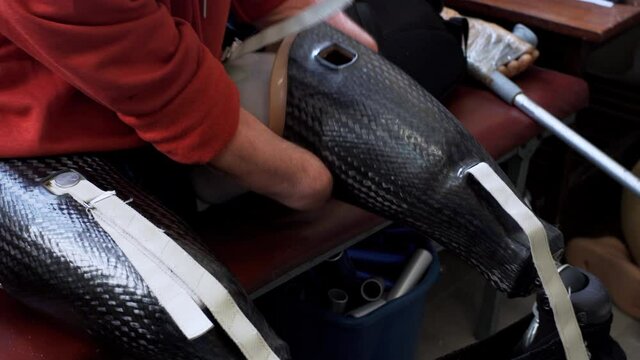 A man living with a disability with amputated legs and arms puts on a modern artificial bionic leg prosthesis trying to fix it with amputated two stump hands 