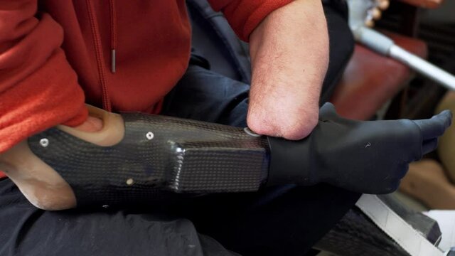 A man living with a disability with amputated both arms is trying to press the button and turn on a new artificial bionic arm prosthesis. Modern artificial arm used by man without arms