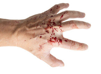 drops of blood on a hand on a white background