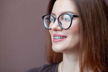 The smile of a young and beautiful girl with braces on her white teeth. Straightening of crooked teeth with the help of a bracket system. Malocclusion. Dental care. Smooth teeth and a beautiful smile