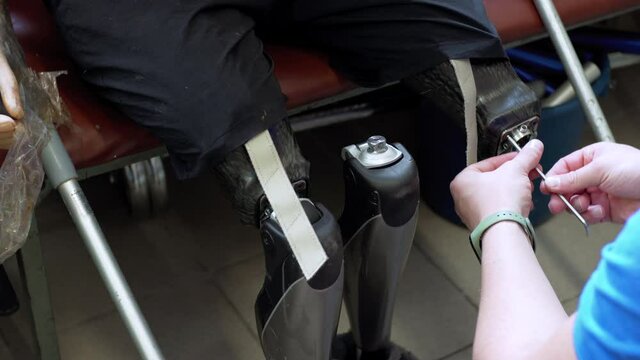 A engineer hands checking the artificial bionic leg prothesis device unscrewing its parts. Maintenance of modern bionic legs prothesis for man living with a disability with amputated legs
