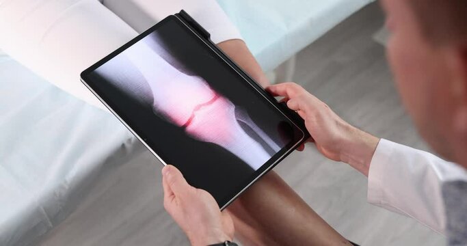 Doctor traumatologist scanning knee joint of woman using digital tablet closeup 4k movie slow motion