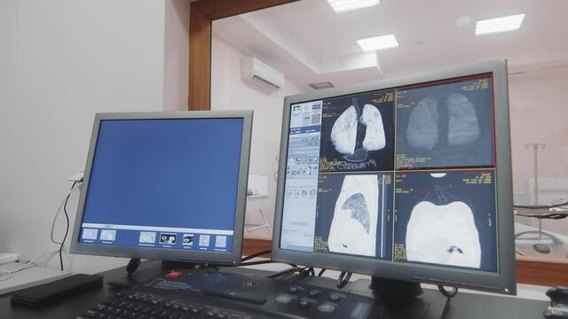 The doctor reviews the MRI results on a computer monitor. MRI analysis of the patient's lungs on a computer