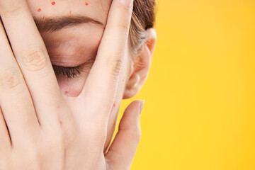 female face cropped view red dots on the face skin problems