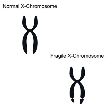 Fragile x syndrome genetics logo icon sign Vector illustrated article on genetic behavioral educational topics Symptoms similar to autism Medical science design Print clothes apparel card cover poster