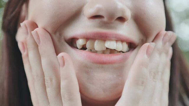 A teenage girl demonstrates her crooked teeth.