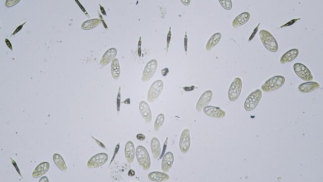 Protozoa single cell organisms in microscope bright field