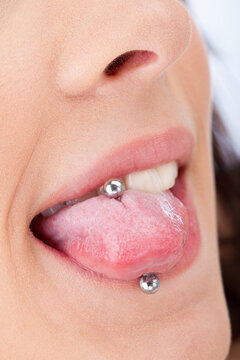Pierced tongue