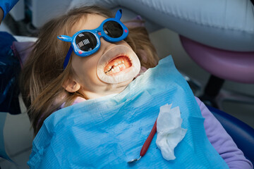 little girl with oral dilator at dentist's appointment. treatment of teeth