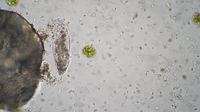 Infusoria is moving its legs and eating something filmed among bacillus under microscope. Primitive organisms are crawling in drop of water. Experiment with planktons and spores made in the laboratory