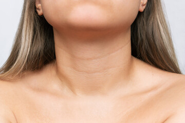 Сlose-up of a young woman's neck and collarbone on a white background. Lines on the neck....