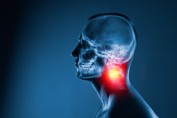 X-ray of a man's head on blue background. The neck spine is highlighted by yellow red colour.