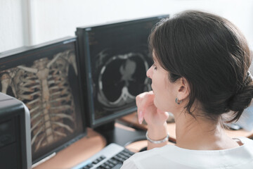 middle east woman doctor looking at monitor with chest bones computer tomography image. female...