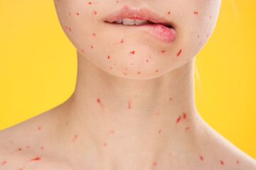 female face cropped view red dots on the face skin problems