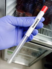 Sterile swab stick in tube with throat swab sample for Throat swab culture and sensitivity test