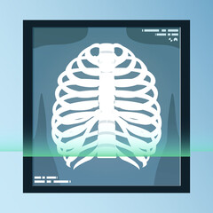 vector of human bones, skeleton and joints on x-ray sheet. medical equipment illustration