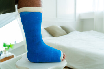 On the right side of the right foot, a man who had a fractured bone accident had a blue cast...
