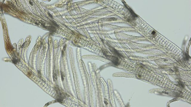 Polychaeta worm, family Sabellidae under a microscope. Video shows Radiole tentacles with many cilia that catch food, as well as gills.
