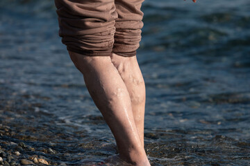 The legs of an elderly woman with altered varicose veins on the background of the sea in autumn....