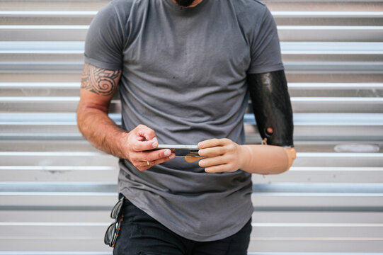 Anonymous content man with prosthetic arm using cellphone