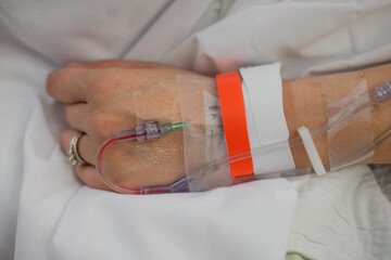 IV intravenous tubes and needle in a Covid infected patient in a hosptial bed
