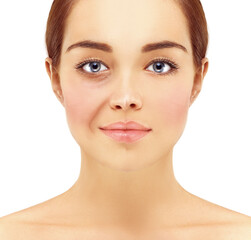 Plastic Surgery Results,Nasolabial folds,Neck ,Under eye circles,neck lines.