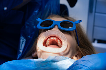 kid with oral dilator at dentist's appointment. treatment of teeth