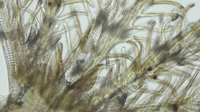 Polychaeta worm, family Sabellidae under a microscope. Video shows Radiole tentacles with many cilia that catch food, as well as gills.