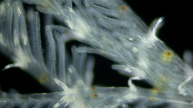 Polychaeta worm, family Sabellidae under a microscope. Video shows Radiole tentacles with many cilia that catch food, as well as gills.
