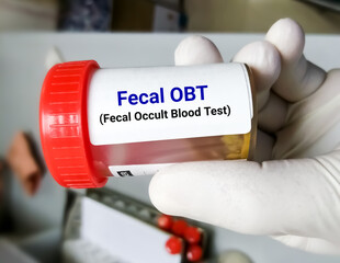 Fecal occult blood test (FOBT). Doctor holding sample container with feces or stool for occult blood test (OBT). - obrazy, fototapety, plakaty