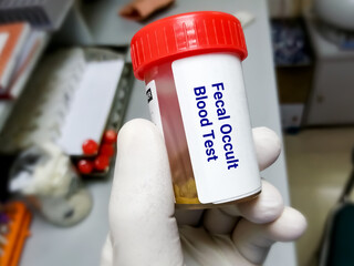 Fecal occult blood test (FOBT). Doctor holding sample container with feces or stool for occult...