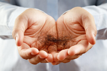 woman slicking hair falling out in two hand after facing hair loss problem of maintenance losing by sad strain cancer patients after receiving chemotherapy. Health care and medical concept.