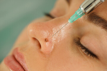 Woman getting injection of local anesthetic before mole removal treatment in a medical aesthetic clinic