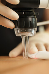 Laser treatment and scar removal after C-section surgery