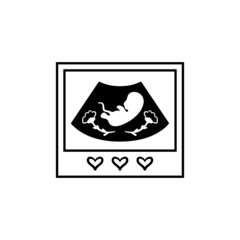 Ultrasound of baby in mother's womb. Pregnancy ultrasound concept symbol. Pregnancy and health, examination procedure of embryo, placenta, umbilical cord. Vector illustration.